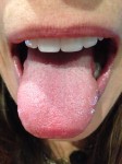 Scrape Your Tongue! 